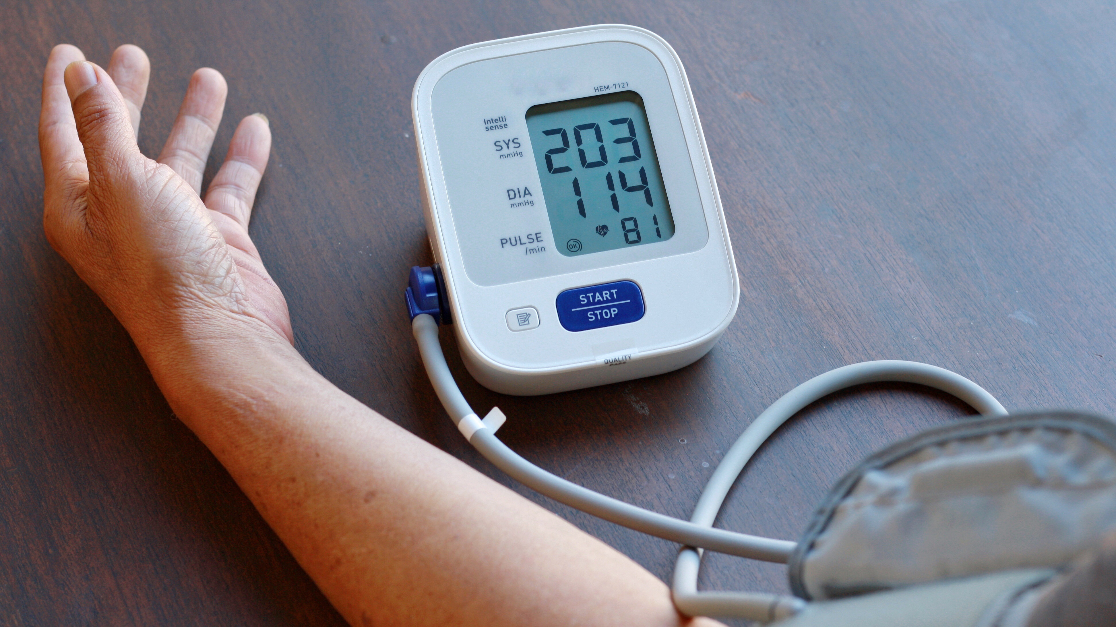 Bluthochdruck – Was tun, wenn der Blutdruck plötzlich viel zu hoch ist?